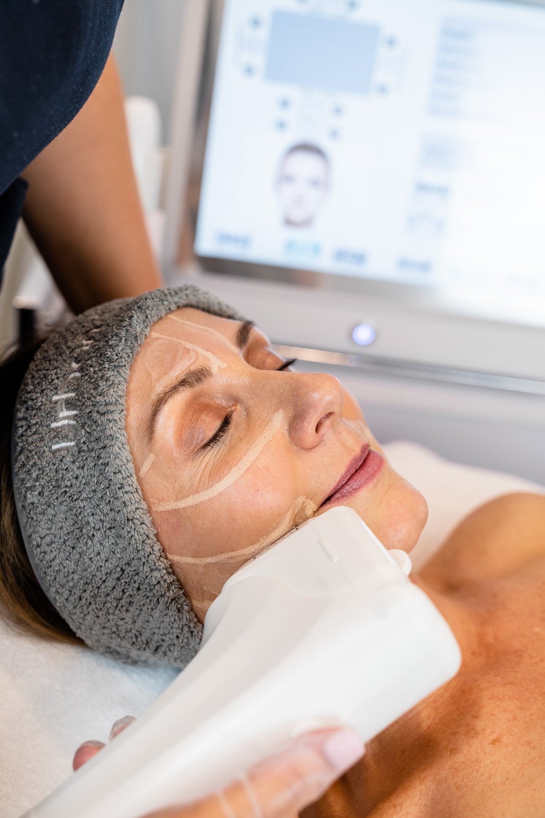 The HIFU non-surgical facelift can fight away the dreaded visible signs of ageing