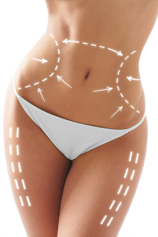 HIFU non-surgical skin tightening