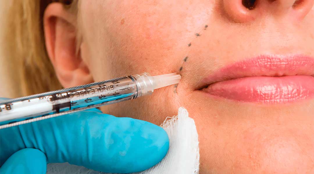 Dermal fillers and anti-wrinkle injections are both capable of fighting the signs of ageing on the face