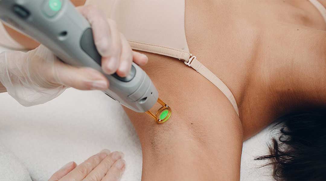 Laser hair removal is a permanent, non-surgical form of hair removal