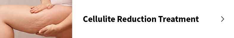 Cellulite reduction treatment