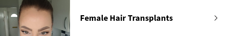 Female hair transplant surgery