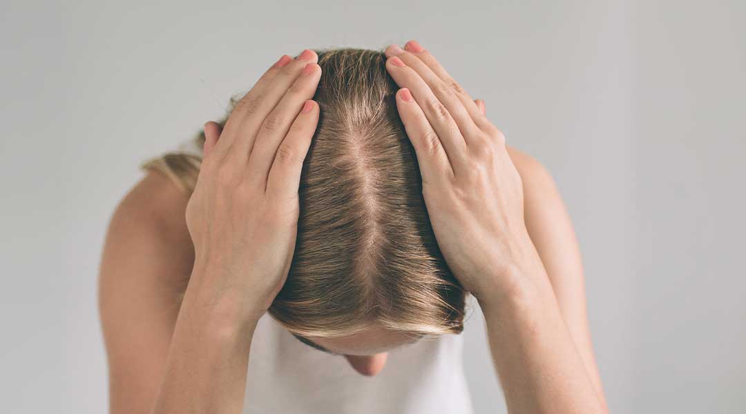 Androgenetic alopecia hair loss in women