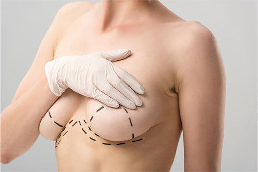 Breast uplift surgery