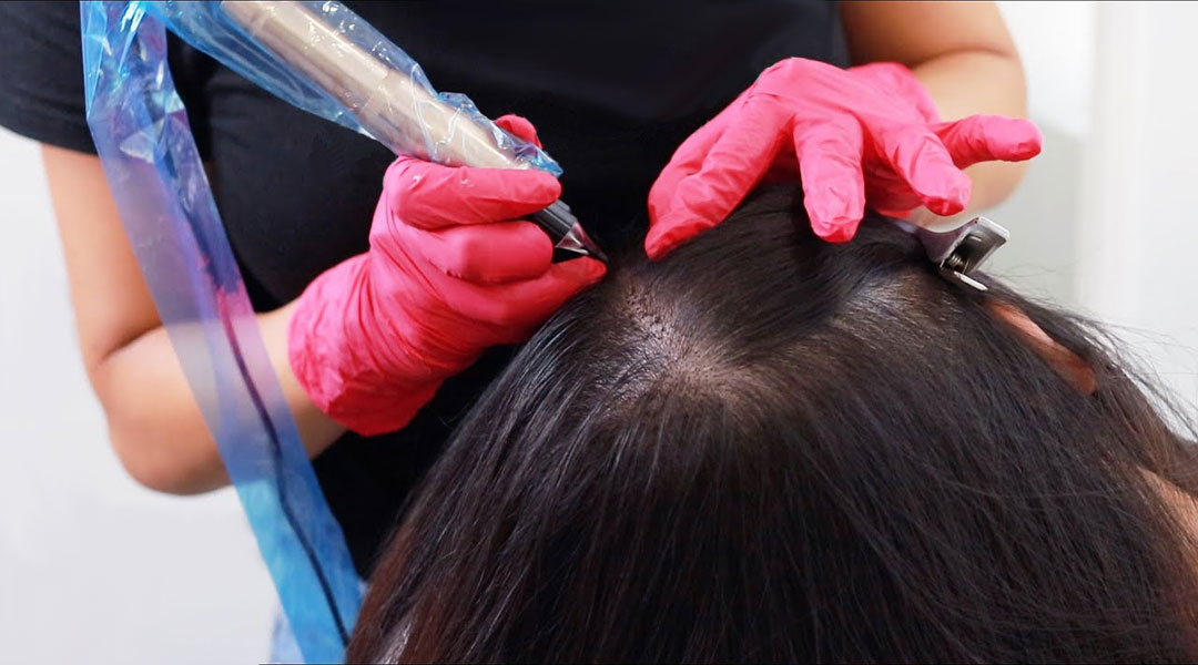 Scalp micropigmentation for women