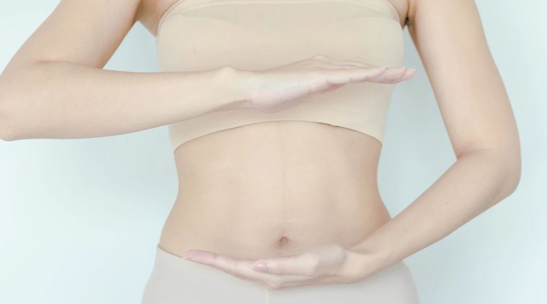 Tummy tuck