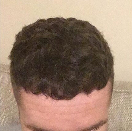 After B