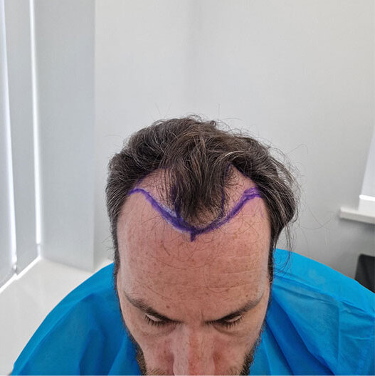 Case C - before